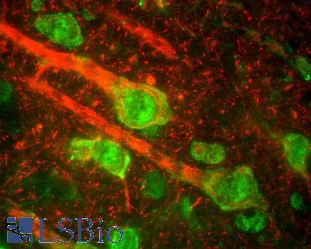 NEFM / NF-M Antibody - Section of rat cerebral cortex stained with NEFM / NF-M antibody (red), which reveals the perikarya of pyramidal neurons and dendrites and axons surrounding them. The green channel shows staining with a monoclonal antibody to the beta-adrenergic receptor kinase 1.