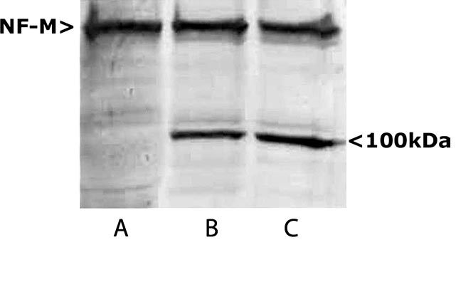 NEFM / NF-M Antibody - Western blots of homogenates of SH-SY5Y cells, a human neuroblastoma cell line. Lane A shows blotting with NEFM / NF-M antibody, which reveals a strong NF-M band at ~150kDa. Lanes B and C are homogenates of SH-SY5Y cells which were treated with maitotoxin to activate caspase family enzymes (ref. 2). Now a ~100kDa band is seen in addition o the major NF-M band. This corresponds to the C-terminal segment of NF-M which is an in vivo calpain degradation product of human NF-M.