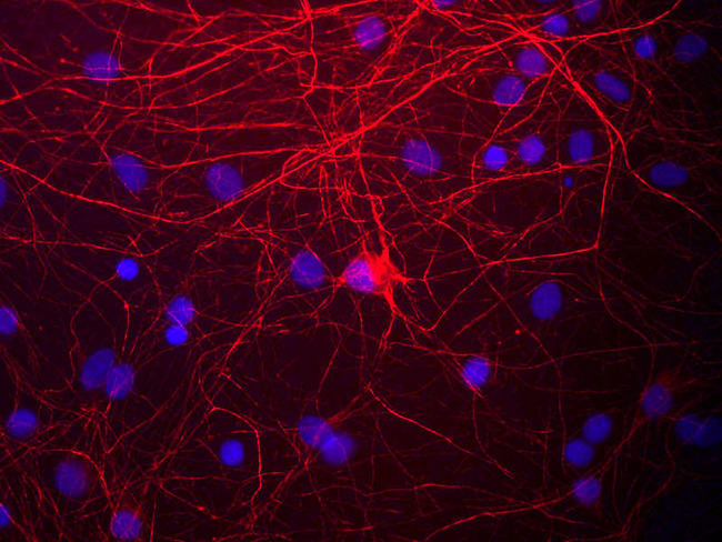 NEFM / NF-M Antibody - View of mixed neuron/glial cultures stained with NEFM / NF-M antibody (red). The NF-M protein is assembled into neurofilaments which are found throughout the axons, dendrites and perikarya of these cells.