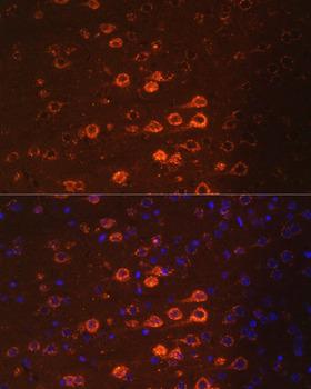 NEFM / NF-M Antibody - Immunofluorescence analysis of Mouse brain using NEFM Polyclonal Antibody at dilution of 1:100.Blue: DAPI for nuclear staining.