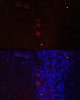 NEFM / NF-M Antibody - Immunofluorescence analysis of Rat brain using NEFM Polyclonal Antibody at dilution of 1:100.Blue: DAPI for nuclear staining.