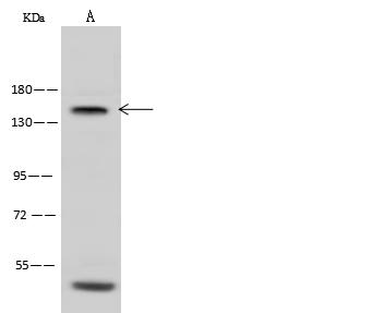 NEFM / NF-M Antibody - Anti-NEFM rabbit polyclonal antibody at 1:500 dilution. Lane A: Mouse brain tissue lysate. Lysates/proteins at 30 ug per lane. Secondary: Goat Anti-Rabbit IgG (H+L)/HRP at 1/10000 dilution. Developed using the ECL technique. Performed under reducing conditions. Predicted band size: 96 kDa.