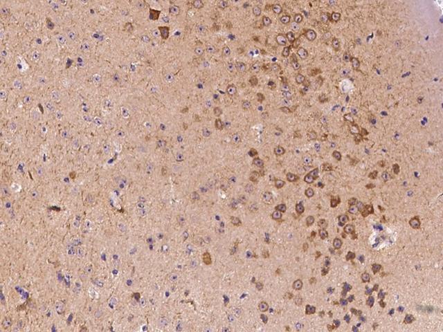 NEFM / NF-M Antibody - Immunochemical staining of mouse NEFM in mouse brain with rabbit polyclonal antibody at 1:2000 dilution, formalin-fixed paraffin embedded sections.