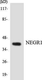 NEGR1 / Neurotractin Antibody - Western blot analysis of the lysates from COLO205 cells using NEGR1 antibody.