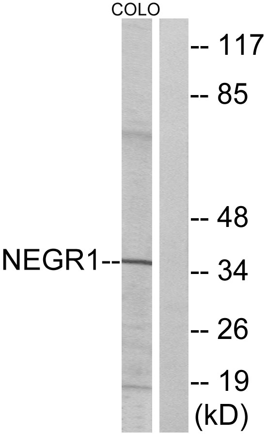 NEGR1 / Neurotractin Antibody - Western blot analysis of lysates from COLO cells, using NEGR1 Antibody. The lane on the right is blocked with the synthesized peptide.