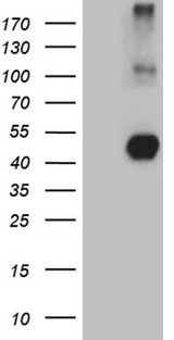 NEGR1 / Neurotractin Antibody - HEK293T cells were transfected with the pCMV6-ENTRY control. (Left lane) or pCMV6-ENTRY NEGR1. (Right lane) cDNA for 48 hrs and lysed. Equivalent amounts of cell lysates. (5 ug per lane) were separated by SDS-PAGE and immunoblotted with anti-NEGR1. (1:2000)