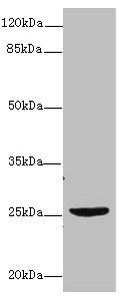 NEGR1 / Neurotractin Antibody - Western blot All lanes: NEGR1 antibody at 4µg/ml + U87 whole cell lysate Secondary Goat polyclonal to rabbit IgG at 1/10000 dilution Predicted band size: 39, 25 kDa Observed band size: 25 kDa
