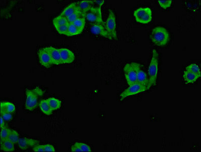 NEGR1 / Neurotractin Antibody - Immunofluorescent analysis of PC-3 cells using NEGR1 Antibody at dilution of 1:100 and Alexa Fluor 488-congugated AffiniPure Goat Anti-Rabbit IgG(H+L)