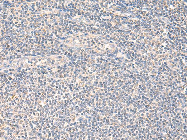 NEGR1 / Neurotractin Antibody - Immunohistochemistry of paraffin-embedded Human tonsil tissue  using NEGR1 Polyclonal Antibody at dilution of 1:90(×200)