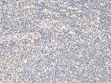 NEGR1 / Neurotractin Antibody - Immunohistochemistry of paraffin-embedded Human tonsil tissue  using NEGR1 Polyclonal Antibody at dilution of 1:90(×200)