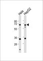 NEI3 / NEIL3 Antibody - All lanes : Anti-NEIL3 Antibody at 1:1000 dilution Lane 1: HeLa whole cell lysates Lane 2: HepG2 whole cell lysates Lysates/proteins at 20 ug per lane. Secondary Goat Anti-Rabbit IgG, (H+L),Peroxidase conjugated at 1/10000 dilution Predicted band size : 68 kDa Blocking/Dilution buffer: 5% NFDM/TBST.