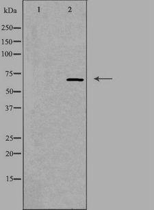 NEI3 / NEIL3 Antibody - Western blot analysis of extracts of COLO cells using NEIL3 antibody.