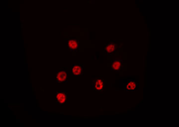 NEI3 / NEIL3 Antibody - Staining HeLa cells by IF/ICC. The samples were fixed with PFA and permeabilized in 0.1% Triton X-100, then blocked in 10% serum for 45 min at 25°C. The primary antibody was diluted at 1:200 and incubated with the sample for 1 hour at 37°C. An Alexa Fluor 594 conjugated goat anti-rabbit IgG (H+L) Ab, diluted at 1/600, was used as the secondary antibody.