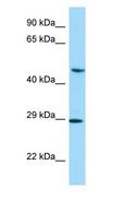 NEIL1 Antibody - NEIL1 antibody Western Blot of PANC1.  This image was taken for the unconjugated form of this product. Other forms have not been tested.