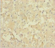 NEIL1 Antibody - Immunohistochemistry of paraffin-embedded human liver tissue using NEIL1 Antibody at dilution of 1:100