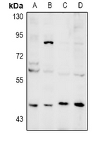 NEIL1 Antibody - Western blot analysis of NEIL1 expression in PC12 (A), AML12 (B), MCF7 (C), A549 (D) whole cell lysates.