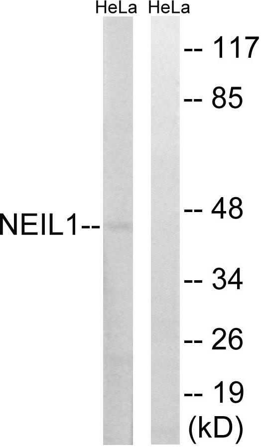 NEIL1 Antibody - Western blot analysis of extracts from HeLa cells, using NEIL1 antibody.