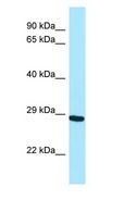 NEIL2 Antibody - NEIL2 antibody Western Blot of THP-1.  This image was taken for the unconjugated form of this product. Other forms have not been tested.
