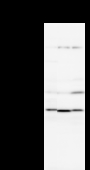 NEIL2 Antibody - Detection of NEIL2 by Western blot. Samples: Whole cell lysate from human HeLa (H, 25 ug) , mouse NIH3T3 (M, 25 ug) and rat F2408 (R, 25 ug) cells. Predicted molecular weight: 36 kDa