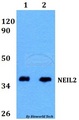 NEIL2 Antibody - Western blot of NEIL2 antibody at 1:500 dilution. Lane 1: HEK293T whole cell lysate. Lane 2: PC12 whole cell lysate.