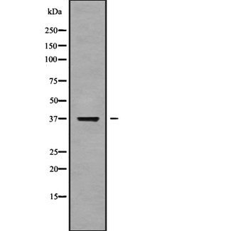 NEIL2 Antibody - Western blot analysis NEIL2 using HuvEc whole cells lysates