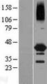 NEIL2 Protein - Western validation with an anti-DDK antibody * L: Control HEK293 lysate R: Over-expression lysate