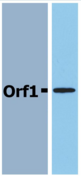 Neisseria meningitidis Orf1 Antibody - Western Blotting analysis (reducing conditions) of recombinant protein Orf1 in cell lysate of Orf1-transfected E. coli using polyclonal anti-Orf1 antibody.