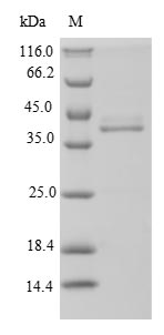 Penicillin-binding protein 1A Protein - (Tris-Glycine gel) Discontinuous SDS-PAGE (reduced) with 5% enrichment gel and 15% separation gel.