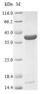 porB Protein - (Tris-Glycine gel) Discontinuous SDS-PAGE (reduced) with 5% enrichment gel and 15% separation gel.