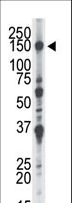 NEK1 Antibody - The anti-NEK1 antibody is used in Western blot to detect NEK1 in CHO cell lysate.