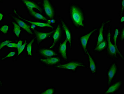 NEK1 Antibody - Immunofluorescence staining of Hela cells at a dilution of 1:100, counter-stained with DAPI. The cells were fixed in 4% formaldehyde, permeabilized using 0.2% Triton X-100 and blocked in 10% normal Goat Serum. The cells were then incubated with the antibody overnight at 4 °C.The secondary antibody was Alexa Fluor 488-congugated AffiniPure Goat Anti-Rabbit IgG (H+L) .