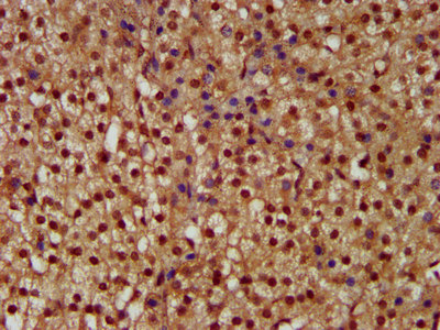 NEK1 Antibody - Immunohistochemistry image at a dilution of 1:300 and staining in paraffin-embedded human adrenal gland tissue performed on a Leica BondTM system. After dewaxing and hydration, antigen retrieval was mediated by high pressure in a citrate buffer (pH 6.0) . Section was blocked with 10% normal goat serum 30min at RT. Then primary antibody (1% BSA) was incubated at 4 °C overnight. The primary is detected by a biotinylated secondary antibody and visualized using an HRP conjugated SP system.
