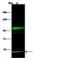 NEK10 Antibody - Anti-NEK10 rabbit polyclonal antibody at 1:500 dilution. Lane A: A431 Whole Cell Lysate. Lysates/proteins at 30 ug per lane. Secondary: Goat Anti- Rabbit  IgG H&L (Dylight 800)  at 1/10000 dilution. Developed using the Odyssey technique. Performed under reducing conditions. Predicted band size: 53 kDa. Observed band size: 53 kDa. (We are unsure as to the identity of these extra bands.)