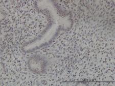 NEK11 Antibody - Immunoperoxidase of monoclonal antibody to NEK11 on formalin-fixed paraffin-embedded human endometrium tissue. [antibody concentration 3 ug/ml].