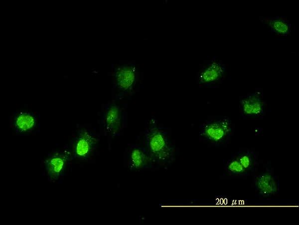 NEK11 Antibody - Immunofluorescence of monoclonal antibody to NEK11 on HeLa cell. [antibody concentration 10 ug/ml]