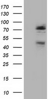 NEK11 Antibody - HEK293T cells were transfected with the pCMV6-ENTRY control (Left lane) or pCMV6-ENTRY NEK11 (Right lane) cDNA for 48 hrs and lysed. Equivalent amounts of cell lysates (5 ug per lane) were separated by SDS-PAGE and immunoblotted with anti-NEK11.