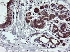 NEK11 Antibody - IHC of paraffin-embedded Human breast tissue using anti-NEK11 mouse monoclonal antibody.