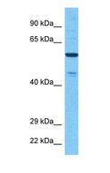NEK11 Antibody - Western blot of NEK11 Antibody with human 721_B Whole Cell lysate.  This image was taken for the unconjugated form of this product. Other forms have not been tested.