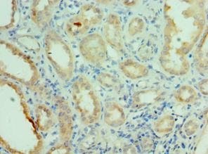 NEK2 Antibody - Immunohistochemistry of paraffin-embedded human kidney using antibody at 1:100 dilution.