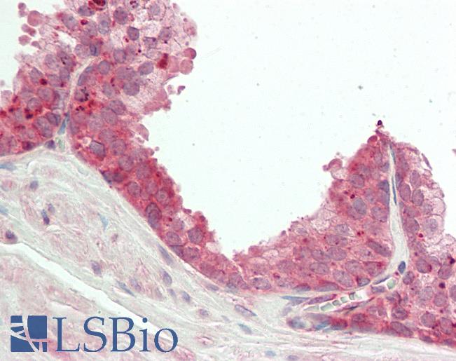 NEK2 Antibody - Human Prostate: Formalin-Fixed, Paraffin-Embedded (FFPE).  This image was taken for the unconjugated form of this product. Other forms have not been tested.