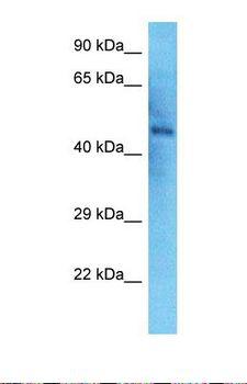 NEK2 Antibody - Western blot of Human Thyroid Tumor. NEK2 antibody dilution 1.0 ug/ml.  This image was taken for the unconjugated form of this product. Other forms have not been tested.