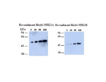 NEK2 Antibody - Western blot of NEK2 antibody.