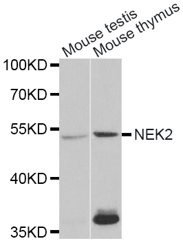 NEK2 Antibody - Western blot analysis of extracts of various cell lines.