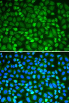 NEK2 Antibody - Immunofluorescence analysis of U2OS cells.