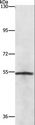 NEK2 Antibody - Western blot analysis of Lovo cell, using NEK2 Polyclonal Antibody at dilution of 1:727.