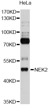 NEK2 Antibody - Western blot analysis of extracts of HeLa cells, using NEK2 antibody at 1:1000 dilution. The secondary antibody used was an HRP Goat Anti-Rabbit IgG (H+L) at 1:10000 dilution. Lysates were loaded 25ug per lane and 3% nonfat dry milk in TBST was used for blocking. An ECL Kit was used for detection and the exposure time was 10s.