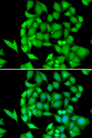 NEK3 Antibody - Immunofluorescence analysis of HeLa cells.