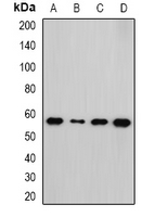 NEK3 Antibody - Western blot analysis of NEK3 expression in HepG2 (A); HeLa (B); mouse kidney (C); rat brain (D) whole cell lysates.