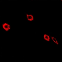 NEK3 Antibody - Immunofluorescent analysis of NEK3 staining in HeLa cells. Formalin-fixed cells were permeabilized with 0.1% Triton X-100 in TBS for 5-10 minutes and blocked with 3% BSA-PBS for 30 minutes at room temperature. Cells were probed with the primary antibody in 3% BSA-PBS and incubated overnight at 4 deg C in a humidified chamber. Cells were washed with PBST and incubated with a DyLight 594-conjugated secondary antibody (red) in PBS at room temperature in the dark.