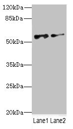 NEK3 Antibody - Western blot All Lanes: NEK3antibody at 6.04ug/ml Lane 1 : MCF7 whole cell lysate Lane 2 : Hela whole cell lysate Secondary Goat polyclonal to Rabbit IgG at 1/10000 dilution Predicted band size: 58,56 kDa Observed band size: 58 kDa